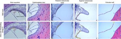 Comparison of Age-Related Pigmentary Changes in the Auditory and Vestibular Systems Within Mouse and Human Temporal Bones